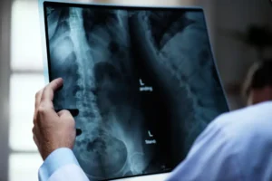 Spine Injury Attorney Back and Neck Injuries After Accidents